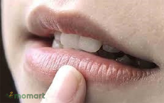 Tác hại của việc làn môi bị thâm đen