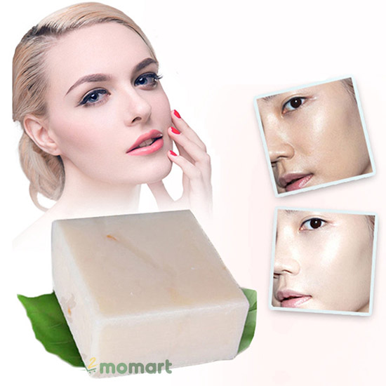 Jam Rice Milk Soap có thể điều trị mụn ở mặt