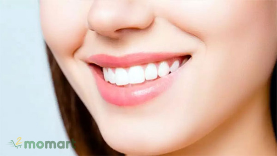 Răng trắng giúp tô điểm cho nụ cười đẹp