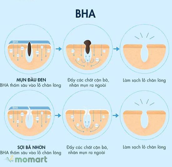 Những điều bạn cần biết về BHA