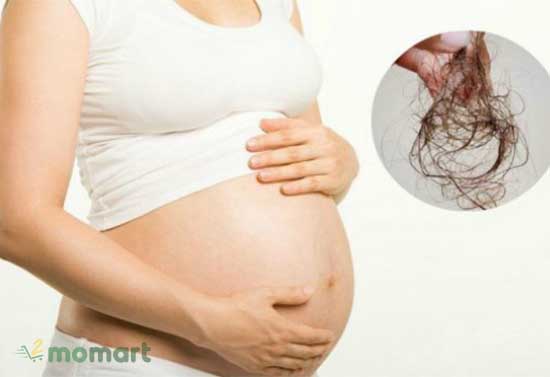 Rụng tóc thời kỳ mang thai và sau sinh