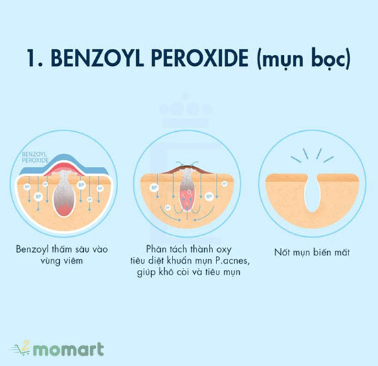 Benzoyl peroxide hoạt động như thế nào