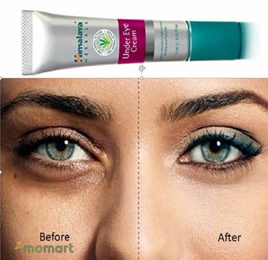 Himalaya Under Eye Cream phù hợp cho mọi loại da