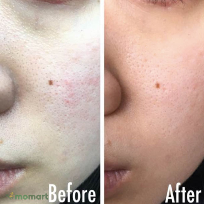 Công dụng của CNP Laboratory Invisible Peeling Booster