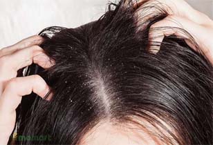 Dầu gội trị chấy thành phần thiên nhiên hiệu quả tốt nhất không hại da đầu